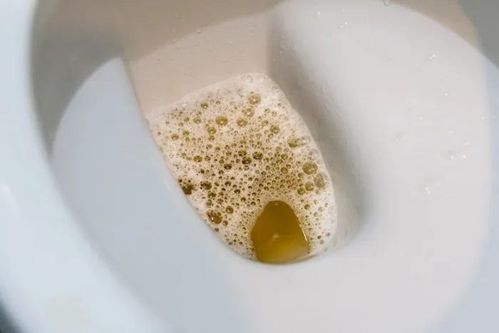 cloudy urine